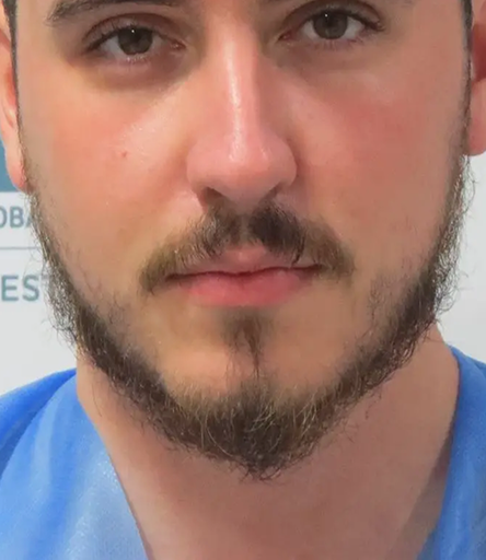 Beard